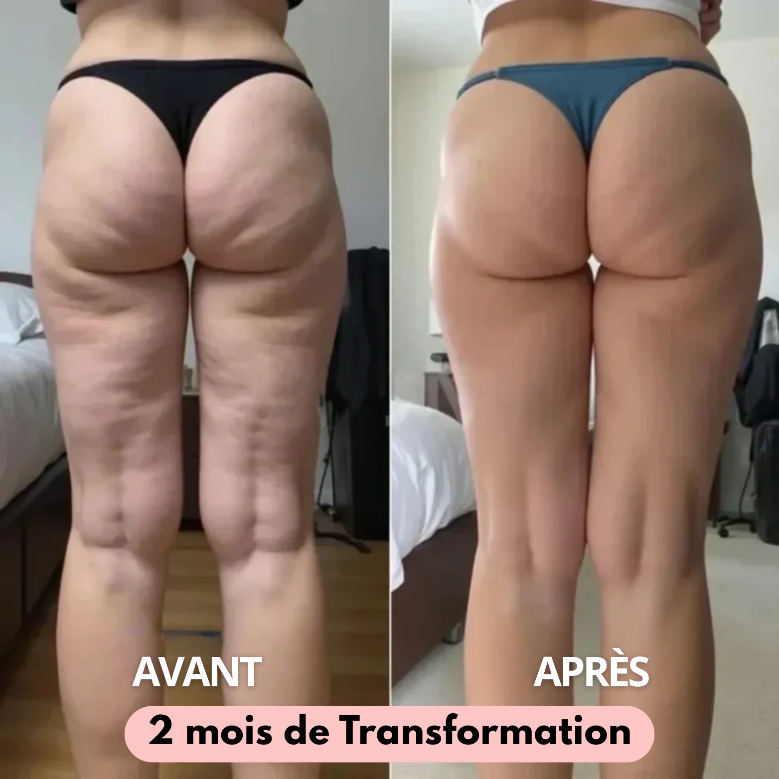 Formule 6-en-1 - Sculptez vos courbes naturellement