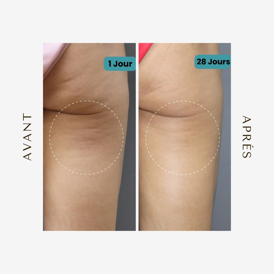 Bradiva- Legging 3D Innovant, Anti Cellulite Confort & Bien-Être